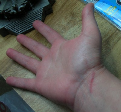 You can barely see the cut on my index finger, but you sure can see that claw mark on my wrist!